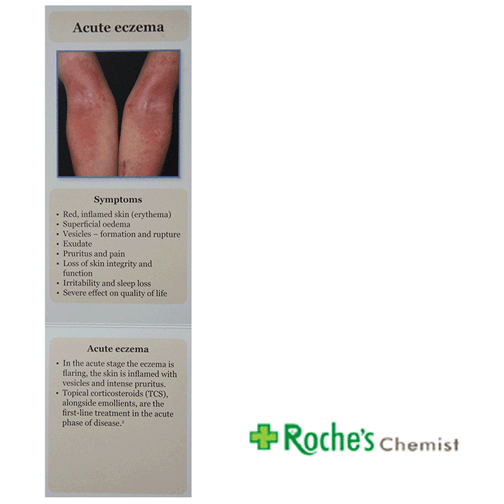 Dermatitis / Eczema – Brighton Healthcare Ltd T/a Roche's Chemist