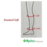 duomed-soft-measurement-diagram.gif